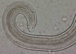 Parasitology: Pinworm Examination Test Offered