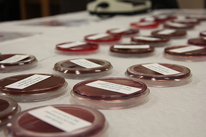 Agar plates of bacterial cultures.