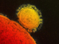 microscopic image of the mers virus
