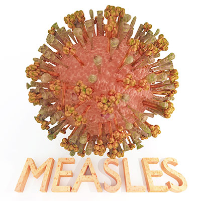 Measles image